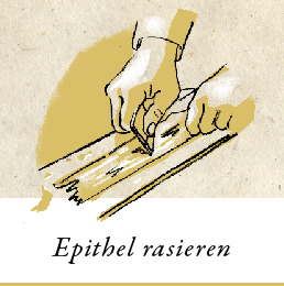 Abbildung: Epithel rasieren
                
